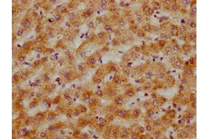 IHC image of ABIN7148519 diluted at 1:200 and staining in paraffin-embedded human liver tissue performed on a Leica BondTM system. (Copine III anticorps  (AA 297-442))