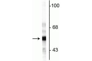 Western blot of rat cerebellar lysate showing specific immunolabeling of the ~57 kDa peripherin protein. (Peripherin anticorps)