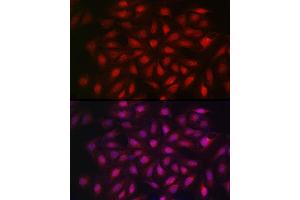 Immunofluorescence analysis of U2OS cells using KPNB1 Rabbit pAb (ABIN6134722, ABIN6142997, ABIN6142998 and ABIN6224723) at dilution of 1:100 (40x lens). (KPNB1 anticorps  (AA 250-350))