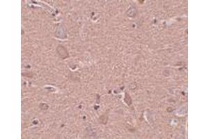 Immunohistochemistry (IHC) image for anti-Sushi-Repeat Containing Protein, X-Linked (SRPX) (N-Term) antibody (ABIN1031585) (SRPX anticorps  (N-Term))