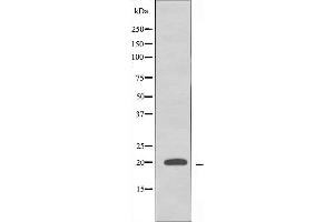 Western blot analysis of extracts from HeLa cells using RPL10L antibody. (RPL10L anticorps  (C-Term))