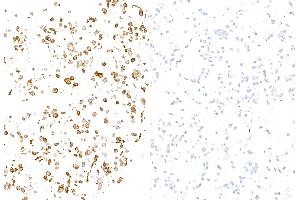 anti-Selectin E (SELE) (AA 22-555) antibody