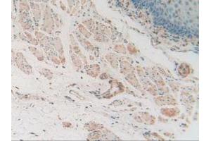 Figure. (RNASE4 anticorps  (AA 30-147))