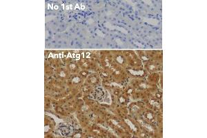 Immunohistochemistry (IHC) image for anti-Autophagy Related 12 (ATG12) (N-Term) antibody (ABIN6254241)