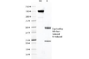 SDS-PAGE Analysis Purified FOLH1 Mouse Monoclonal Antibody (FOLH1/2121). (PSMA anticorps  (AA 232-433))
