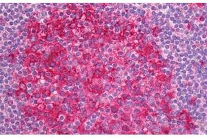 Anti-Alpha Tubulin antibody IHC staining of human tonsil, germinal center.