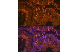 Immunofluorescence analysis of rat testis using SRD5 Rabbit mAb (ABIN7270595) at dilution of 1:100 (40x lens).
