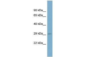 WB Suggested Anti-RAB23 Antibody Titration: 0. (RAB23 anticorps  (N-Term))