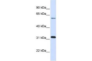 LGALS3 antibody used at 1 ug/ml to detect target protein.