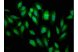 Immunofluorescence staining of Hela cells with ABIN7145788 at 1:66, counter-stained with DAPI.