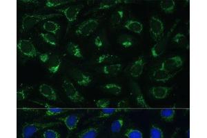 Immunofluorescence analysis of U-2 OS cells using ETFB Polyclonal Antibody at dilution of 1:100 (40x lens).