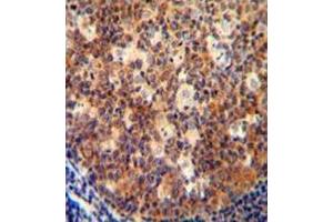 Immunohistochemistry analysis in human tonsil tissue (formalin-fixed, paraffin-embedded) using Interleukin-12 beta/IL12B Antibody (C-term), followed by peroxidase conjugation of the secondary antibody and DAB staining. (IL12B anticorps  (C-Term))