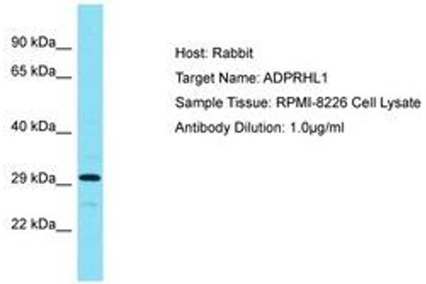 ADPRHL1 antibody  (AA 120-169)