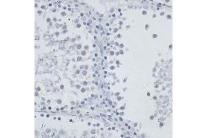 Immunohistochemistry of paraffin-embedded rat testis using MSH6 antibody (ABIN7268710) at dilution of 1:100 (40x lens). (MSH6 anticorps  (AA 1-290))