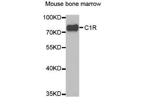 Western blot analysis of extracts of mouse bone marrow, using C1R antibody. (C1R anticorps)