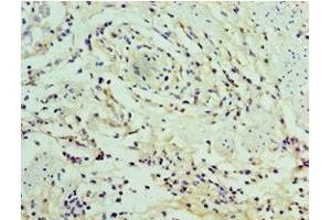 Immunohistochemistry of paraffin-embedded human epityphlon tissue using ABIN7169332 at dilution of 1:100 (SERPINA12 anticorps  (AA 20-320))