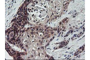 Image no. 7 for anti-Fragile X Mental Retardation 1 (FMR1) (AA 26-279) antibody (ABIN1491292)