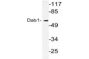 Western blot (WB) analyzes of Dab1 antibody in extracts from HepG2 cells. (DAB1 anticorps)