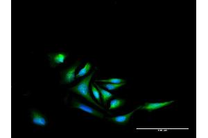 Immunofluorescence of purified MaxPab antibody to NR4A2 on HeLa cell. (NR4A2 anticorps  (AA 1-598))