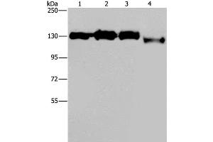 Western Blot analysis of Hela, 293T, Raji and 231 cell using GTF2I Polyclonal Antibody at dilution of 1:400 (GTF2I anticorps)