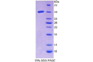 SDS-PAGE analysis of Human NPC2 Protein. (NPC2 Protéine)