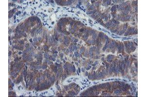 Image no. 7 for anti-Prefoldin Subunit 3 (PFDN3) antibody (ABIN1501700)