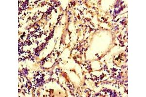 Immunohistochemistry of paraffin-embedded human appendix tissue using ABIN7147801 at dilution of 1:100 (IRG1 anticorps  (AA 57-257))
