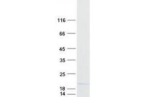 Validation with Western Blot