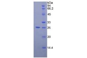 SDS-PAGE of Protein Standard from the Kit  (Highly purified E.