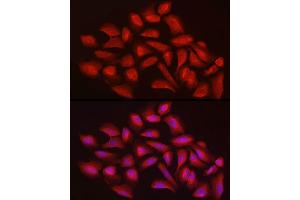 Immunofluorescence analysis of U2OS cells using EXT1 Rabbit pAb (ABIN3022736, ABIN3022737, ABIN3022738 and ABIN6219202) at dilution of 1:100 (40x lens). (EXT1 anticorps  (AA 467-746))