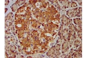 IHC image of ABIN7159000 diluted at 1:400 and staining in paraffin-embedded human pancreatic tissue performed on a Leica BondTM system.