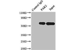 Immunoprecipitating PAK2 in Raji whole cell lysate Lane 1: Rabbit control IgG instead of ABIN7127664 in Raji whole cell lysate. (Recombinant PAK2 anticorps)