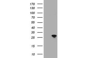 Image no. 1 for anti-B-Cell CLL/lymphoma 10 (BCL10) antibody (ABIN1496850) (BCL10 anticorps)