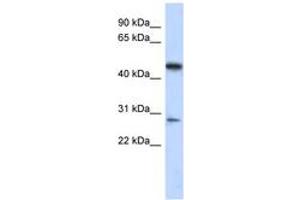 Image no. 1 for anti-Chromosome 13 Open Reading Frame 31 (C13orf31) (AA 179-228) antibody (ABIN6743720) (LACC1 anticorps  (AA 179-228))