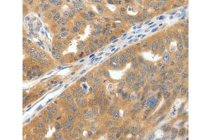 Immunohistochemistry (IHC) image for anti-Sodium Channel, Voltage-Gated, Type IX, alpha Subunit (SCN9A) antibody (ABIN2426871) (SCN9A anticorps)