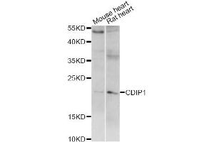 Western blot analysis of extracts of various cell lines, using CDIP1 antibody (ABIN6293220) at 1:1000 dilution. (CDIP1 anticorps)