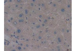 Detection of AMPK Alpha 1 in Human Liver Tissue using Polyclonal Antibody to Protein Kinase, AMP Activated Alpha 1 (AMPK Alpha 1) (PRKAA1 anticorps  (AA 28-257))