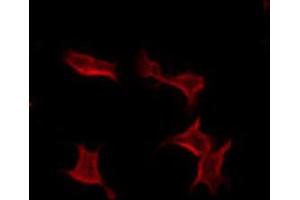 ABIN6274339 staining COLO205 by IF/ICC. (TUSC3 anticorps  (Internal Region))