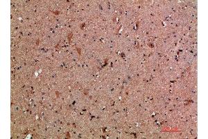 Immunohistochemical analysis of paraffin-embedded human-brain, antibody was diluted at 1:200