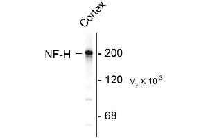 Western blots of rat cortex lysate showing specific immunolableing of the ~ 200k NF-H protein. (NEFH anticorps)