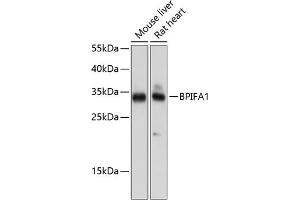 Western blot analysis of extracts of various cell lines, using BPIF antibody (ABIN6132500, ABIN6137634, ABIN6137635 and ABIN6224733) at 1:1000 dilution. (BPIFA1 anticorps  (AA 20-256))
