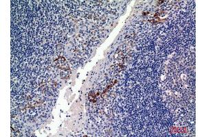 Immunohistochemistry (IHC) analysis of paraffin-embedded Human Tonsils, antibody was diluted at 1:100. (CD19 anticorps  (Internal Region))