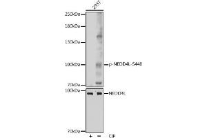 Western blot analysis of extracts of 293T cells, using Phospho-NEDD4L-S448 pAb (ABIN7266883) at 1:1000 dilution or NEDD4L antibody (ABIN6132407, ABIN6144504, ABIN6144505 and ABIN6224109). (NEDD4-2 anticorps  (pSer448))