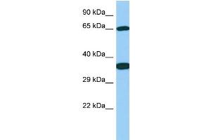 Host: Rabbit Target Name: Galnt13 Sample Type: Rat Stomach lysates Antibody Dilution: 1. (GALNT13 anticorps  (C-Term))