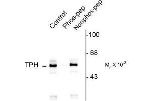 Image no. 1 for anti-Tryptophan Hydroxylase 1 (TPH1) (pSer260) antibody (ABIN372733) (Tryptophan Hydroxylase 1 anticorps  (pSer260))