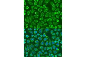 anti-Sorting Nexin 32 (SNX32) (AA 144-403) antibody