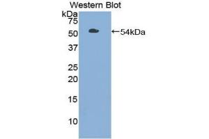 Western blot analysis of the recombinant protein. (TLR3 anticorps  (AA 727-905))