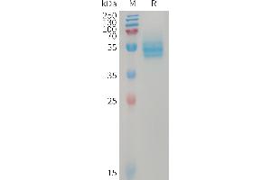 Human CD14(20-344) Protein, His Tag on SDS-PAGE under reducing condition.