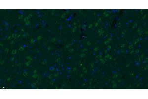 Paraformaldehyde-fixed, paraffin embedded rat brain, Antigen retrieval by boiling in sodium citrate buffer (pH6) for 15min, Block endogenous peroxidase by 3% hydrogen peroxide for 30 minutes, Blocking buffer (normal goat serum) at 37°C for 20min, Antibody incubation with Progestin Receptor Beta/MPRB Antibody  at 1:400 overnight at 4°C, followed by a conjugated secondary Goat Anti-Rabbit IgG antibody -FITC) for 90 minutes, and DAPI for nuclei staining. (Progestin Receptor beta/mprb (AA 251-300) anticorps)
