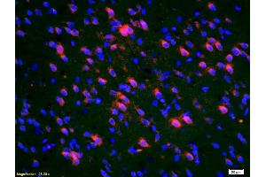 Formalin-fixed and paraffin-embedded rat brain labeled with Anti-Deltex 1 Polyclonal Antibody, Unconjugated (ABIN668125) 1:200, overnight at 4°C, The secondary antibody was Goat Anti-Rabbit IgG, Cy3 conjugated used at 1:200 dilution for 40 minutes at 37°C.